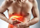 5 Possible Signs Of A Failing Liver That Should Not Be Overlooked