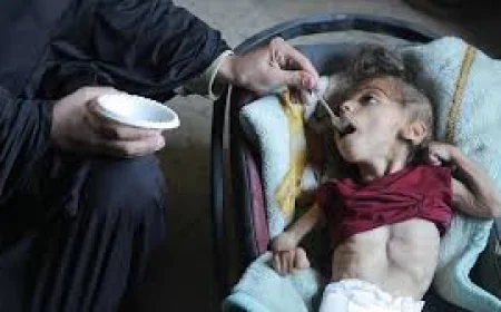 Starvation Used as a Weapon of War Amid Israeli Blockade