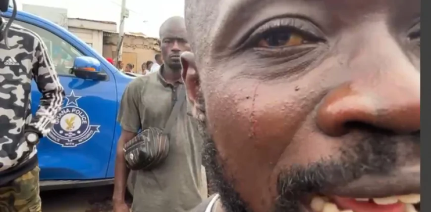 Police Officer Allegedly Slaps Journalist at Ablekuma North Rerun